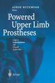 Powered Upper Limb Prostheses.jpg